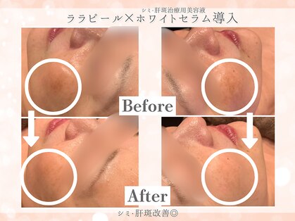 フレイヤ(FREYA)の写真