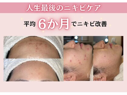 ルオン(Luon.)の写真