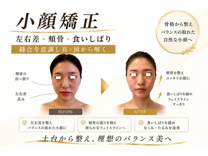 エミナル(EMINALu)の写真