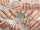 エムジーネイル(Mg Nail)の写真