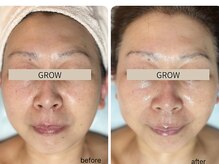 グロウ バイ フェイシャルデザイン アンド アイ(GROW)の雰囲気(お悩み別で施術をご提案♪実績はフォトギャラリー&ブログにて★)
