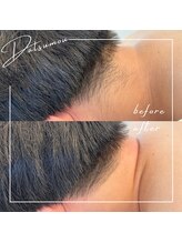 テンポフェリーチェ 浜松店(Tempo Felice)/浜松脱毛/都度払い/メンズ脱毛