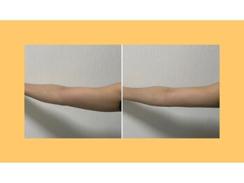 パーフェクトボディ(PERFECT BODY)/二の腕スリムを諦めない!