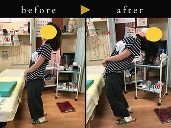 杉本接骨鍼灸院/若々しい背骨を取り戻す整体