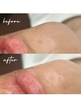 ロコワックス(Loco wax)/フェイスワックス