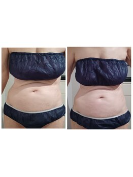 ルクソール/レモンボトル(痩身)