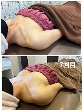 ロココ 豊田店(Rococo)/ビフォーアフター