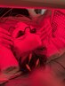 美容鍼時のLEDライト追加 ¥1,000