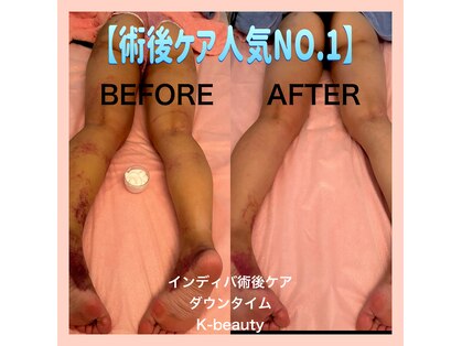 ケイビューティ(k-beauty)の写真