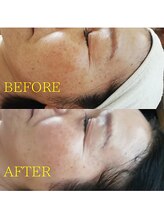 ブルーム(BLOOM)/フェイシャルエステ