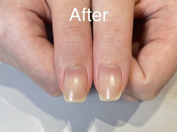 アンドネイル 海老名(&nail)/ブログのS様★Afterです