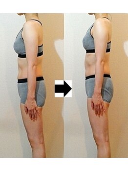 リ アパートメント(Re;apartment)/巻肩、前傾姿勢のつらさも改善