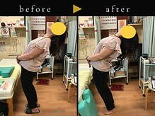 杉本接骨鍼灸院/若々しい背骨を取り戻す整体