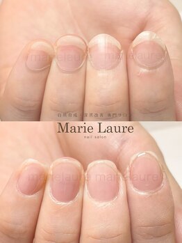 マリーロール 淀屋橋本店(Marie Laure)/自爪育成/深爪矯正/ネイルケア