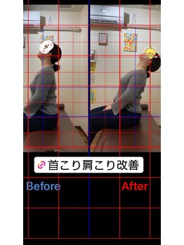 ヒデ整体院(Hide整体院)/猫背矯正骨盤矯正B/A肩こり腰痛