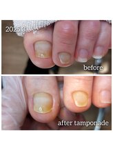 爪切り屋 足楽/