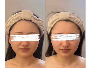 ジョワ 黒崎店(joie)/一度でスッキリ