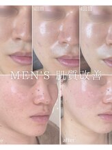 ルリエベル(Relier Belle)/肌悩み諦めないで