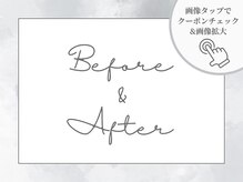 サイバーエステ 宇都宮店/Before&After