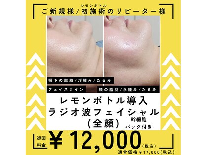 ボーテボナー(Beaute Bonheur)の写真