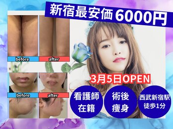 新宿術後インディバサロン【看護師監修/インディバ/ダウンタイムケア/都度払い】/