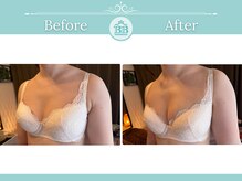 美人バスト 浜松店/◇ バストアップ &nbsp;BeforeAfter◇