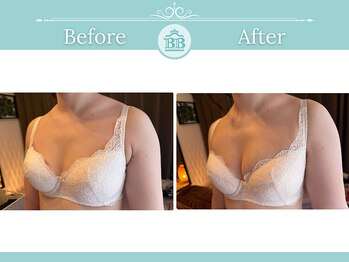 美人バスト 浜松店/◇ バストアップ BeforeAfter◇