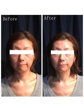 たくろう鍼灸院 豊田本院/Before＆After