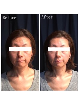 たくろう鍼灸院 豊田本院/Before&After