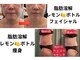 ファム 蓮台寺店(FAM)の写真/【リピーター続出!脂肪分解レモンボトル】レモンボトル痩身は脂肪を効率よく分解☆早く結果を出したい方に!