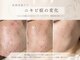 エステティックサロン シーズの写真