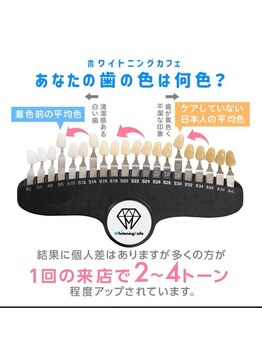 歯のホワイトニング 岐阜アクティブG店の写真/＜まずはお試し1200円～！＞「ちょっと気になる」大歓迎◎JR岐阜駅から直結で通いやすい好立地◎