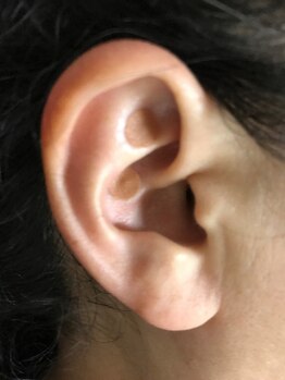 中国気功整体 同仁堂/[耳つぼ]