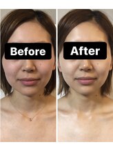 小顔コルギサロン シー(She)/【コルギ】1度の変化!