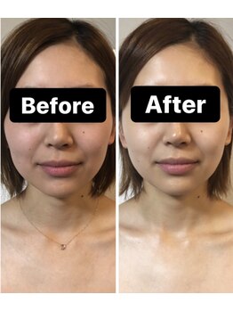 小顔コルギサロン シー(She)/【コルギ】1度の変化!