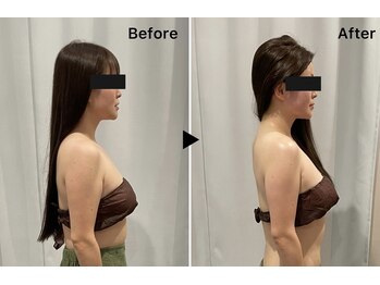 レミュー(Les mieux)/猫背改善！姿勢美人