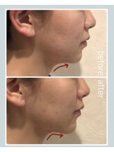 レイール(Reir)/ジーリフト