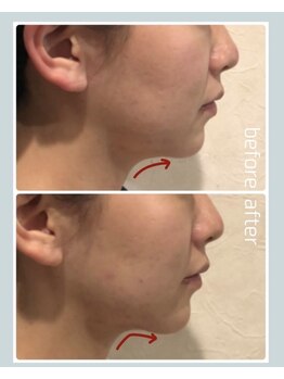 レイール(Reir)/ジーリフト