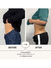 オーシャン整骨院(OCEAN整骨院)/ダイエット3ヶ月コース