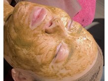 ドクターヴィー 高知(DrVi)/ニキビ跡にハーブピーリング