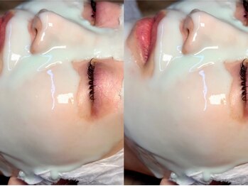 リル バイ アンドアール(Rire by and.R)の写真/毛穴の開き、黒ずみ、つまりなど毛穴改善に特化したフェイシャルでツヤツヤなお肌へ♪