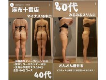 メルローズ 麻布十番店(Melrose)の雰囲気（キレイに"ガリ痩せ"！！結果にこだわり、全力サポート！！）