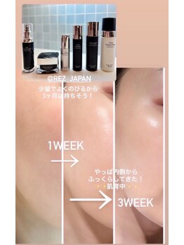 アンジー(an.g)/【韓国フェイシャル】