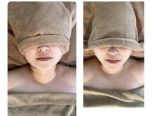 いちごいちえの雰囲気（オプションの1番人気の小顔矯正のビフォーアフター！）