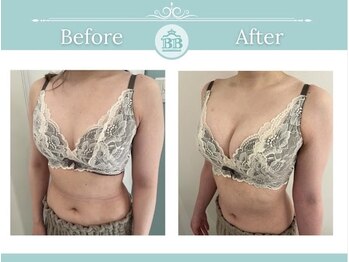 美人バスト 岡山店/バストアップ・バストケア症例★
