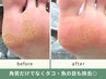 単品予約OK★【足裏角質ケア(45～60分)】タコ・魚の目までケア◎男性もOK!
