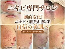 ペシュア(pecheA)