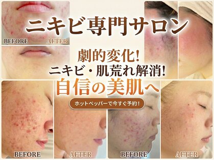 ペシュア(pecheA)の写真