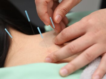 Fitness Lounge Syncの写真/【鍼灸が不安】気になっているけど不安。という方でも安心できるように入念なカウンセリングから☆