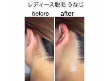 アオドットアール(Ao.r)/一度でこんなに変わる！